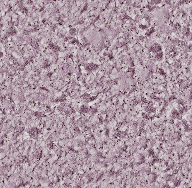 Жидкие шелковые обои Пластер Виктория Б-713 (4 м2)